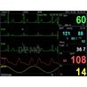 Monitor multiparametrico PC-3000 de 7"