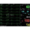 Monitor multiparametrico PC-3000 de 7"