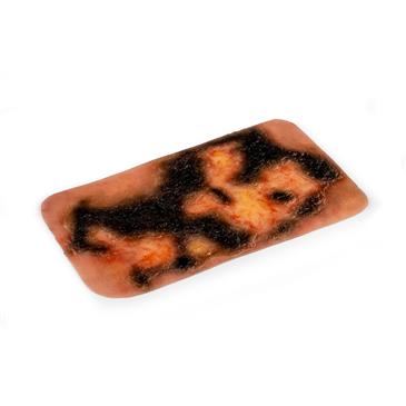 Molde de heridas por quemadura de tercer grado. 16,7 x 9,5 x 0,5 cm