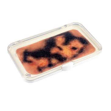Molde de heridas por quemadura de tercer grado. 16,7 x 9,5 x 0,5 cm