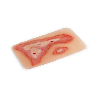 Molde "herida por quemaduras" 17 x 9,5 x 0,5 cm