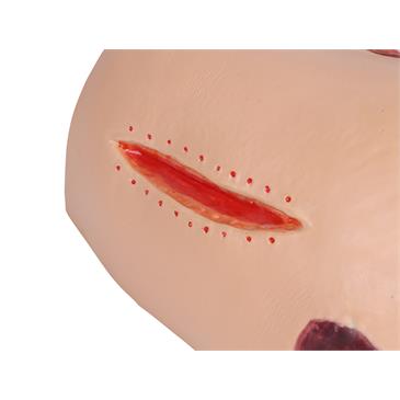Simulador de cuidados y vendajes Decubitus Dan