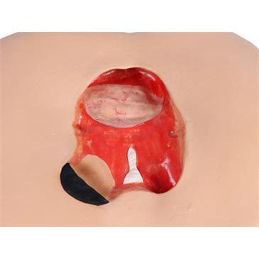 Simulador de cuidados y vendajes Decubitus Dan