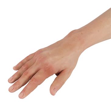 Brazo de entrenamiento intravenoso, tono de piel claro Puncture Pete
