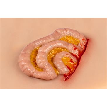 Herida que sobresale del intestino delgado