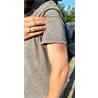 Hematoma antiguo