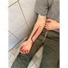 Herida antebrazo Intento de suicidio