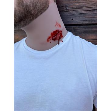 Herida de arma blanca en el cuello