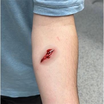 Set de 8 heridas