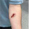 Set de 8 heridas
