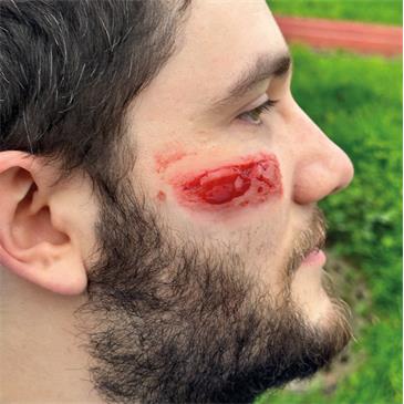 Set de 8 heridas
