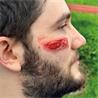 Set de 8 heridas