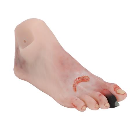 Pie herido con síndrome del pie diabético, versión maniquí Pie herido con síndrome del pie diabético, versión maniquí