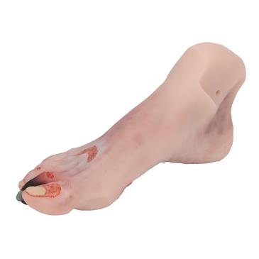 Pie herido con síndrome del pie diabético, versión maniquí