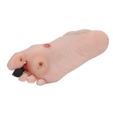 Pie herido con síndrome del pie diabético, versión maniquí