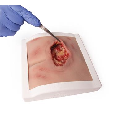 Herida en decúbito sacro, limpiado, soporte incluido.