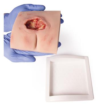 Herida en decúbito sacro, limpiado, soporte incluido.