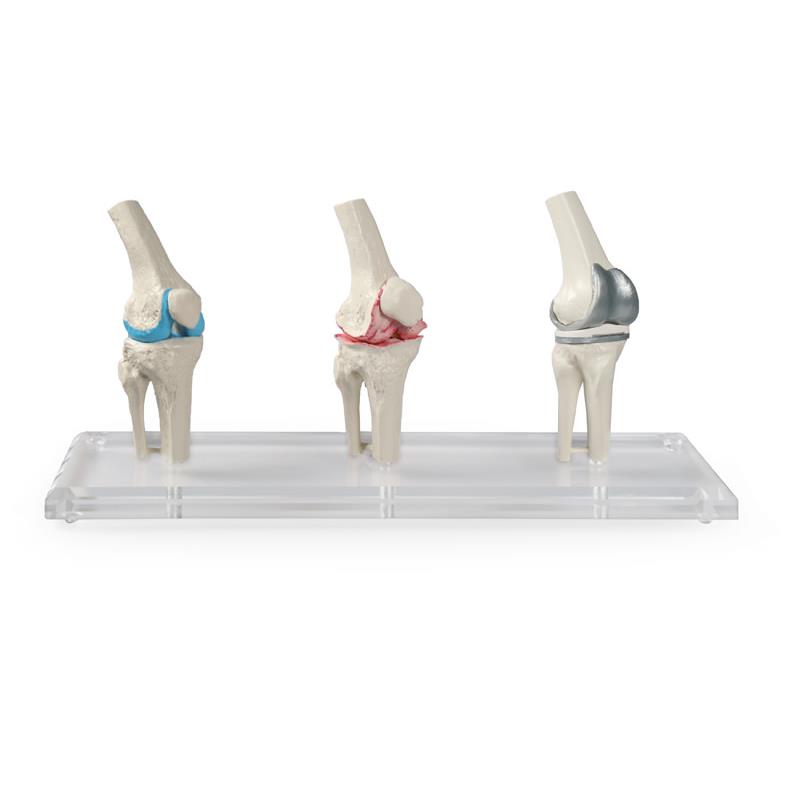 Modelo de rodilla