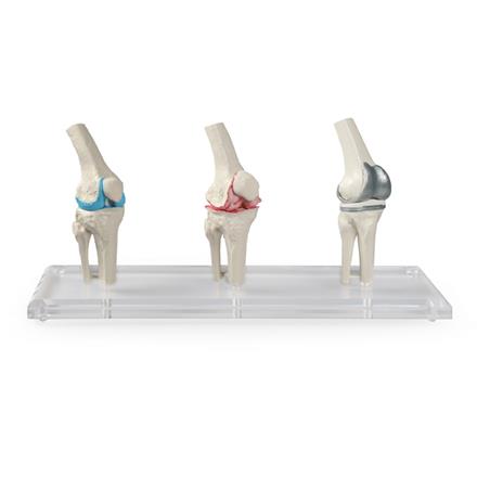 Modelo de rodilla Modelo de rodilla