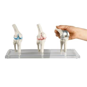 Modelo de rodilla