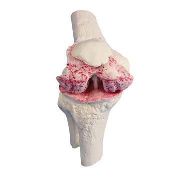Modelo de rodilla