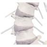 Columna vertebral con pelvis