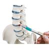 Columna vertebral con prolapso y pelvis desmontable