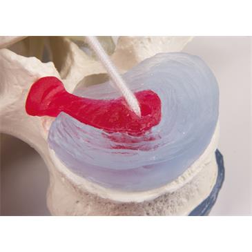 Vértebras lumbares con prolapso de discos intervertebrales con soporte