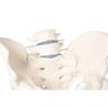Pelvis masculina con sacro, 2 vértebras lumbares y fémur