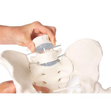 Pelvis masculina con sacro, 2 vértebras lumbares y fémur