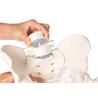 Pelvis masculina con sacro, 2 vértebras lumbares y fémur