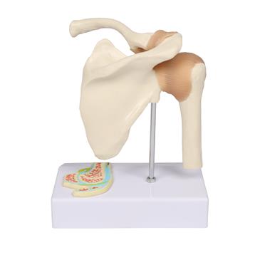 Articulación del hombro con corte transversal en miniatura
