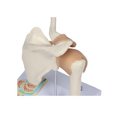 Articulación del hombro con corte transversal en miniatura