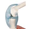Articulación de rodilla con ligamentos
