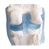 Articulación de rodilla con ligamentos