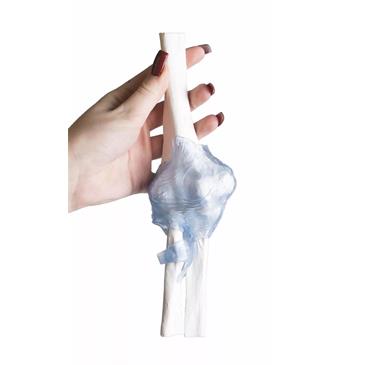 Articulación del codo con ligamentos