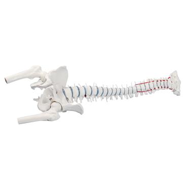 Columna vertebral estándar con hernia discal, partes femorales y pelvis