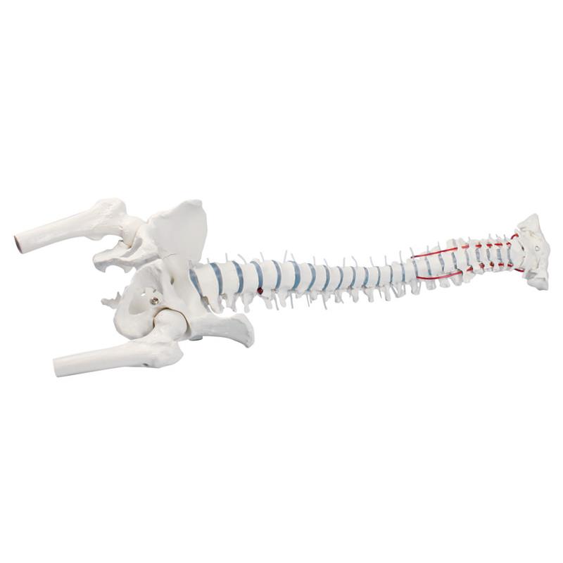 Columna vertebral estándar con hernia discal, partes femorales y pelvis