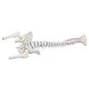 Columna vertebral estándar con hernia discal, partes femorales y pelvis