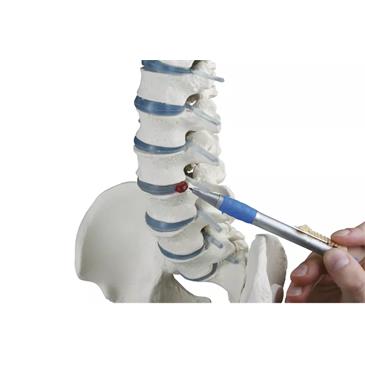 Columna vertebral estándar con hernia discal, partes femorales y pelvis