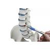 Columna vertebral estándar con hernia discal, partes femorales y pelvis