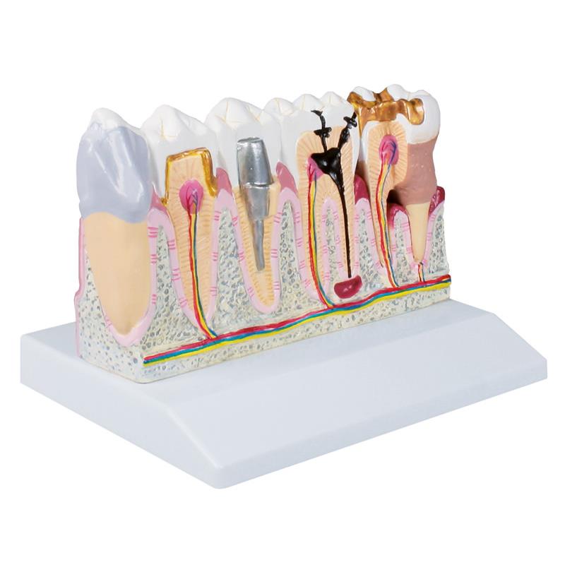 Modelo dental inferior derecho, 4 veces su tamaño natural