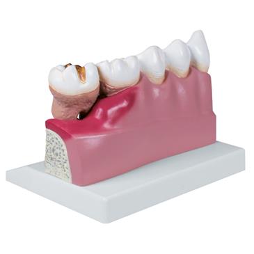 Modelo dental inferior derecho, 4 veces su tamaño natural