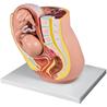 Modelo de pelvis con feto de 32 semanas embarazo
