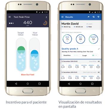 Espirómetro Spirobank Smart