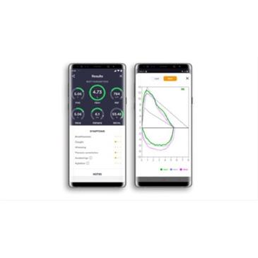 Espirómetro Spirobank Smart