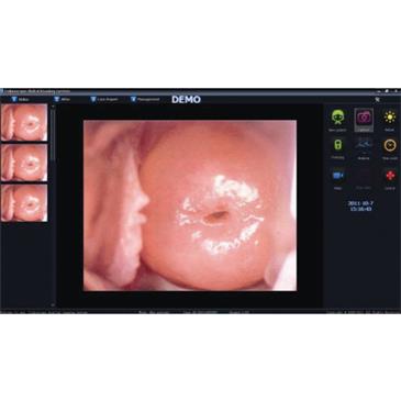 Software para videocolposcopio EYD23706