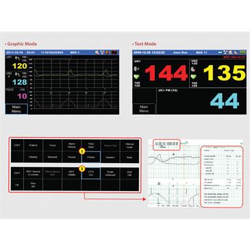 Monitor fetal gemelar