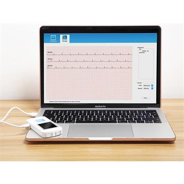 ECG portátil con software y bluetooth