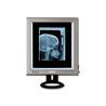 Negatoscopio 1 pantalla LED extraplano de mesa. 42x36 cm
